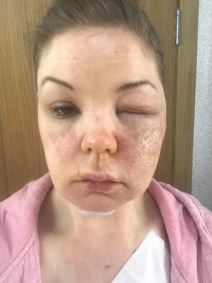 jaja iz mikrotalasne eksplozija opasnost