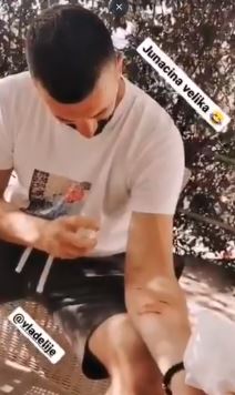 vladimir tomovic rane ruka twitter foto