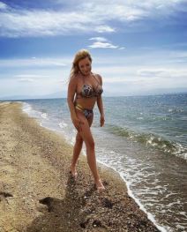 Ivana Jordan o plastičnim operacijama i botoksu