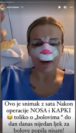 Ermina Pašović plastične operacije