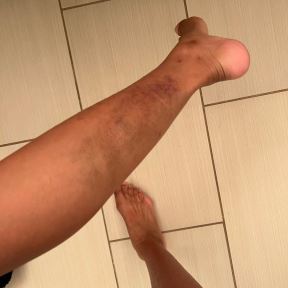 NBA zvezda Majls Bridžis pretukao ženu