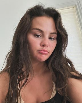 Selena Gomez lupus