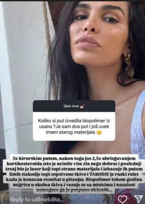 Jovana Đorđević o plastičnim operacijama unakazili je