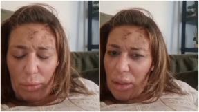 Ana Nikolić u povredama