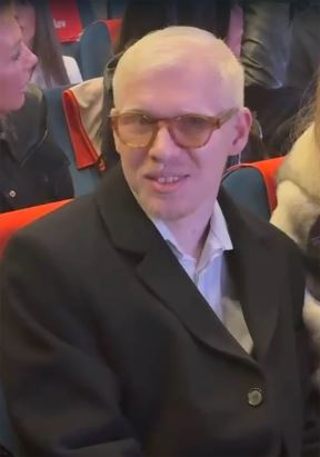 Albino (2).jpg