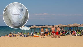Riba-zec ujela ženu na plaži u Grčkoj