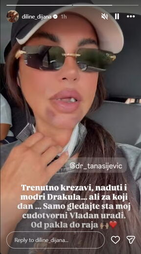 Dijana Dilajn