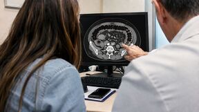 Doktor pokazuje pacijentkinji rak debelog creva