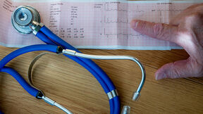 Ekg na stolu