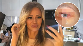 Kristina Kika Živković brutalno pretučena.jpg