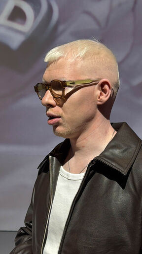 Albino (2).jpg