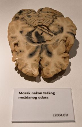 Šta se krije u ljudskom telu