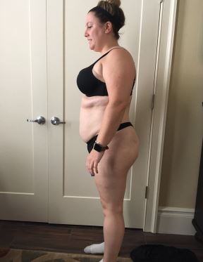 liposukcija trening mršavljenje transformacija promena dijeta