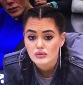 Ana Korać pre plastičnih operacija