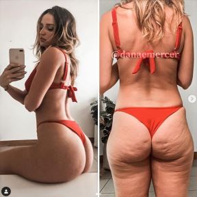 savrsene fotografije instagram danae mercer celulit strije