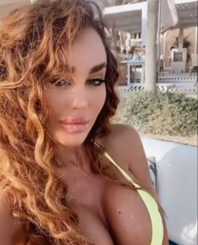 Eleonora Miljković plastične operacije