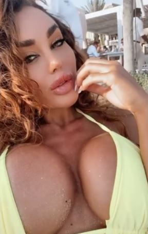 Eleonora Miljković plastične operacije