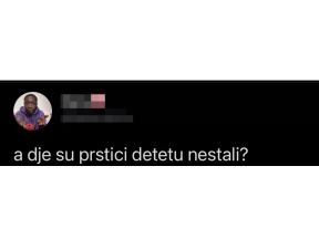 ana rajkovic fotosop izbrisala sinu prste foto