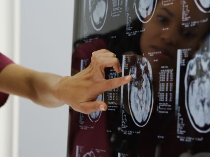 Žena rukom pokazuje na analizu mozga