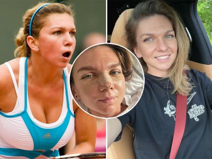 Simona-Halep-operacije.jpg