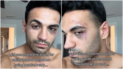 Žalio se da ga je devojka udarila jer joj nije spremio doručak, a pokazao psa