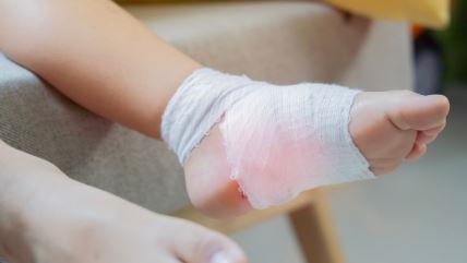 Dete zadobilo opekotine od svetlećih patika.jpg