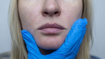 Doktorka rukom drži pacijentkinju za licu.