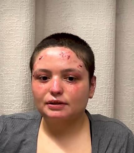 Preživela žrtva požara u Švajcarskoj (2).jpg