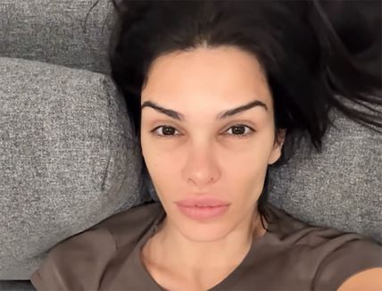 Jovana Đorđević se požalila da joj opada kosa