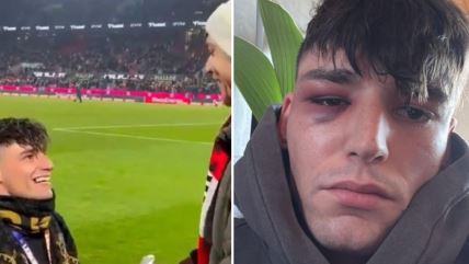 Sudija pretučen posle prosidbe na stadionu