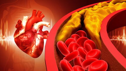 arterije, srce