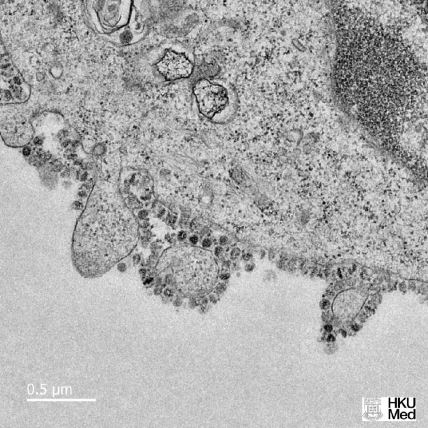 Koronavirus kako se razmnožava