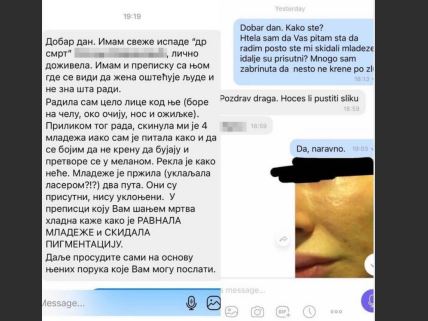 plazma pen iskustva oziljci zeljana milanovic kozmeticki salon