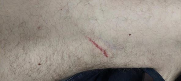NASTAVNIK TVRDI DA GA NAPAO KOLEGA (3).jpg
