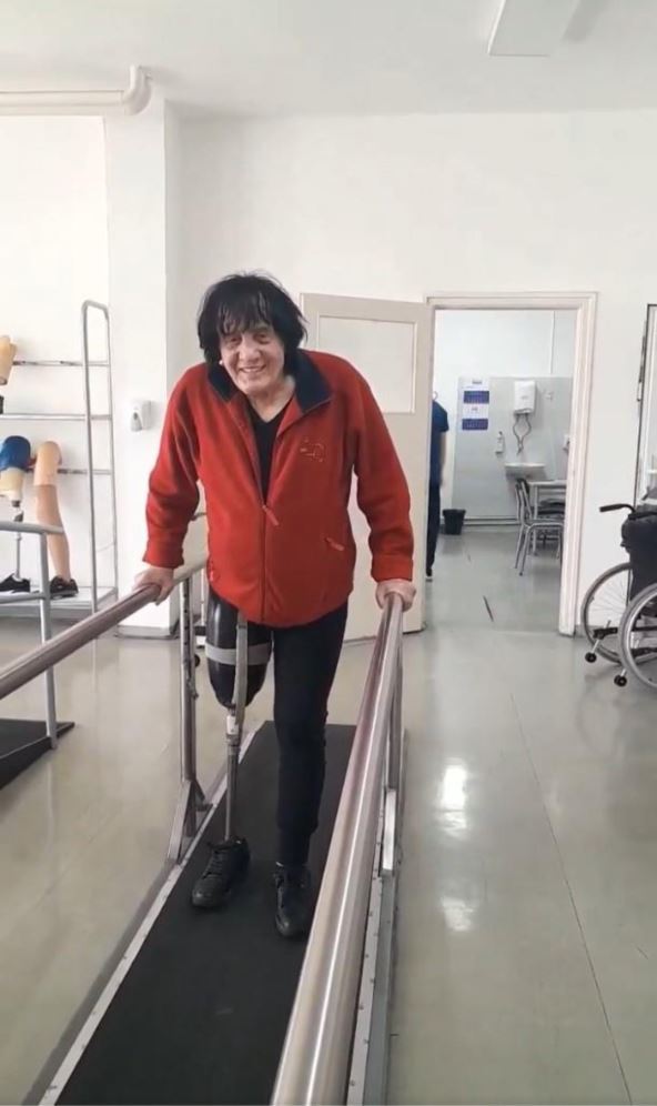 Milić dobio protezu