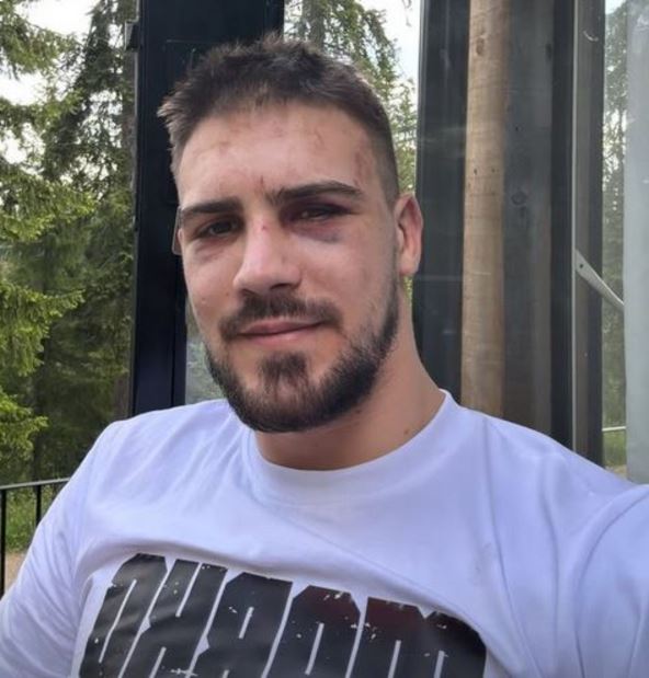 Marko Bojković MMA borac polazao lice