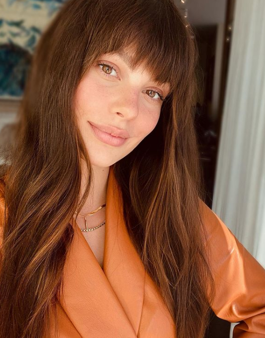 Stepenaste šiške su ove godine doživele svoj procvat.