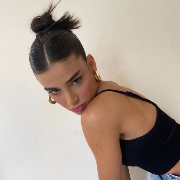 Jako zategnuta kosa dovodi do bola u vlasištu.