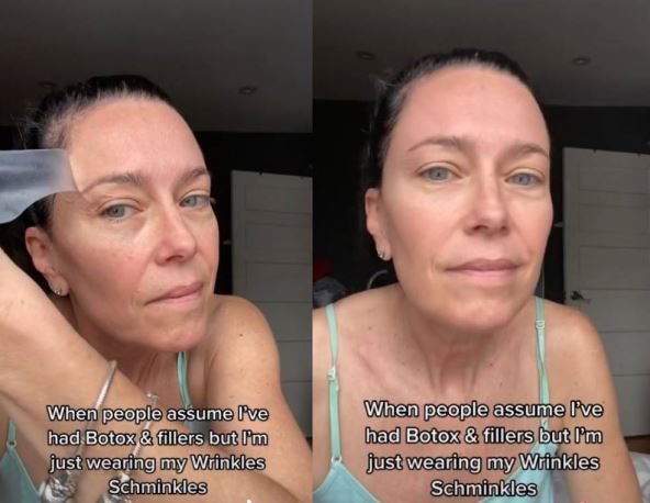 Da li ovi flasteri zaista rade kao botoks i fileri?