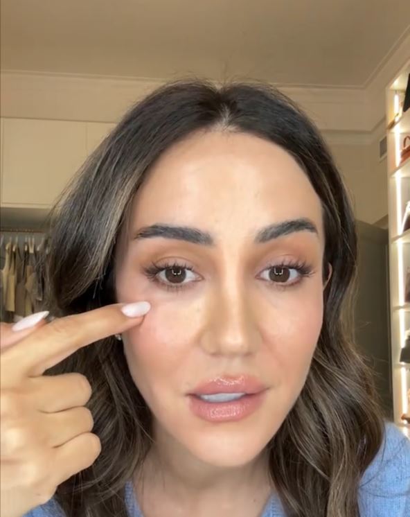 Tamara Kalinić ožiljak na obrazu