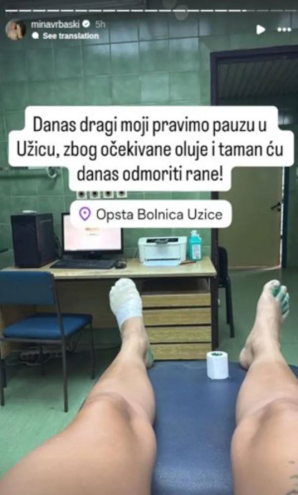 Mina Vrbaški povrede u bolnici