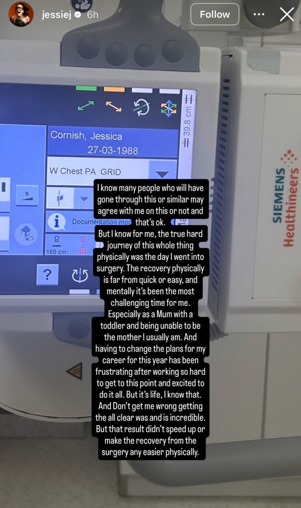 Džesi Džej u bolnici nakon problema sa plućima