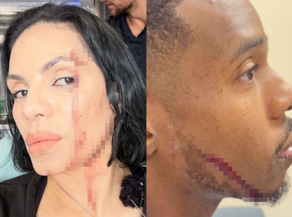 Nina i Patrik nakon incidenta