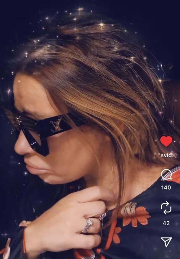 Ana Nikolić sa odsečenom kosom