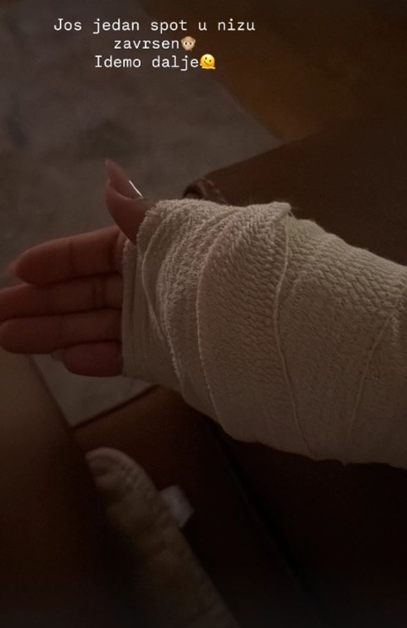 Nadica Ademov povredila ruku