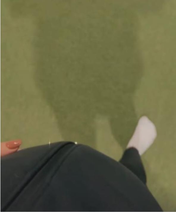 Aleksandra Bursać trudnički stomak