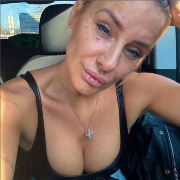 Milica Dabović se oglasila nakon oepracije