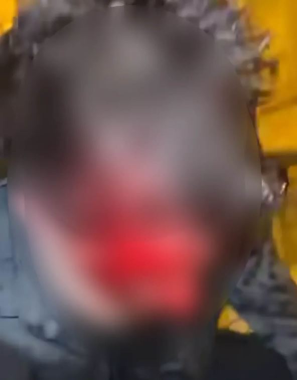 pretučen mladić zagreb (2).jpg