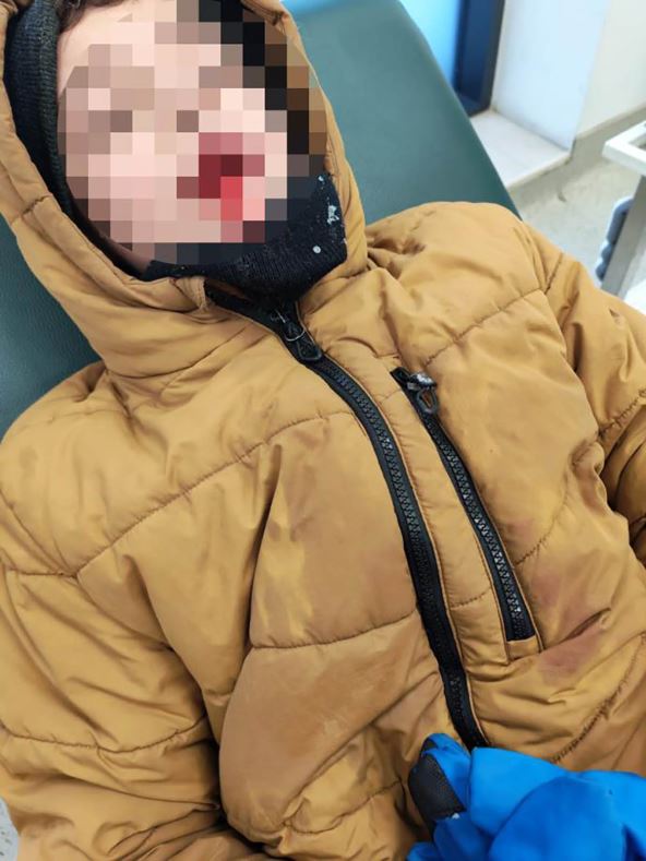 Pas lutalica napao dečaka u Obrenovcu