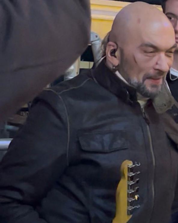 Ognjan Radivojević Ogi sutradan sa povredama